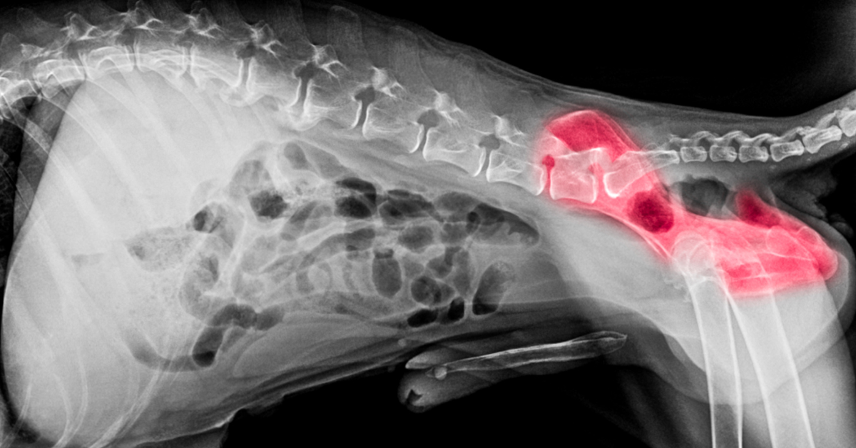 Legg-Calve-Perthes Disease